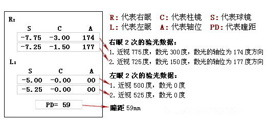 眼科醫(yī)生教你如何一分鐘看懂驗(yàn)光單！