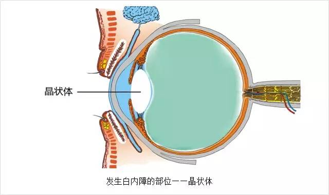 眼科主任告誡白內(nèi)障這幾大誤區(qū)，80%的老人上當